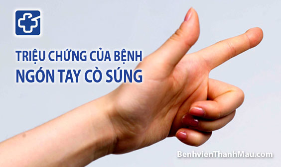 trieu chung ngon tay bat trieu chung benh ngon tay co sung