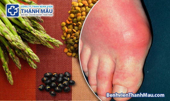 bệnh gout bệnh gút kiêng rau gì