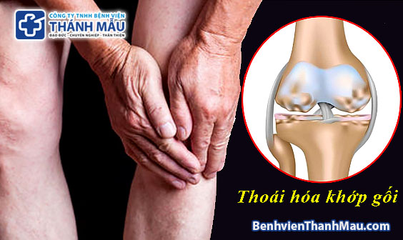 thoái hóa khớp ăn gì tốt thoái hóa khớp gối ăn gì tốt