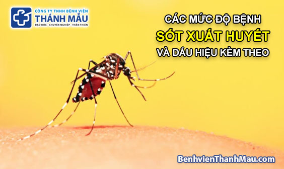 cac muc do benh sot xuat huyet va dau hieu kem theo