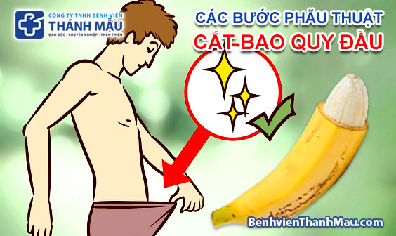 các bước phẫu thuật cắt bao quy đầu cắt bao quy đầu ở tphcm