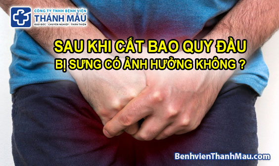 cắt bao quy đầu bị sưng tư vấn cắt bao quy đầu