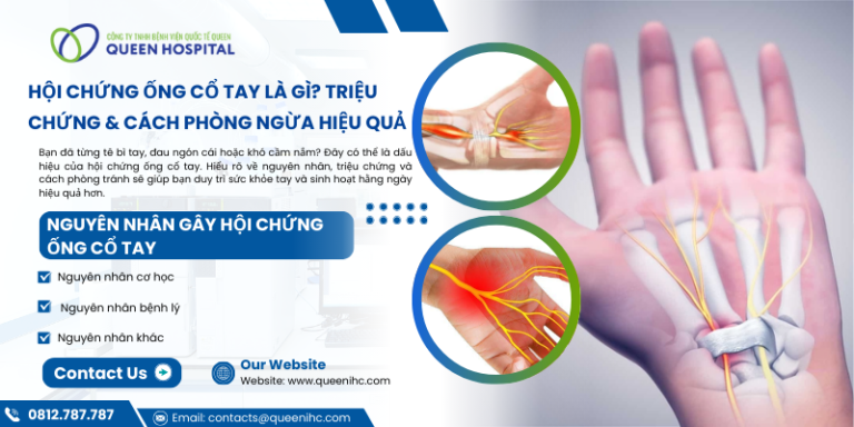 hội chứng ống cổ tay