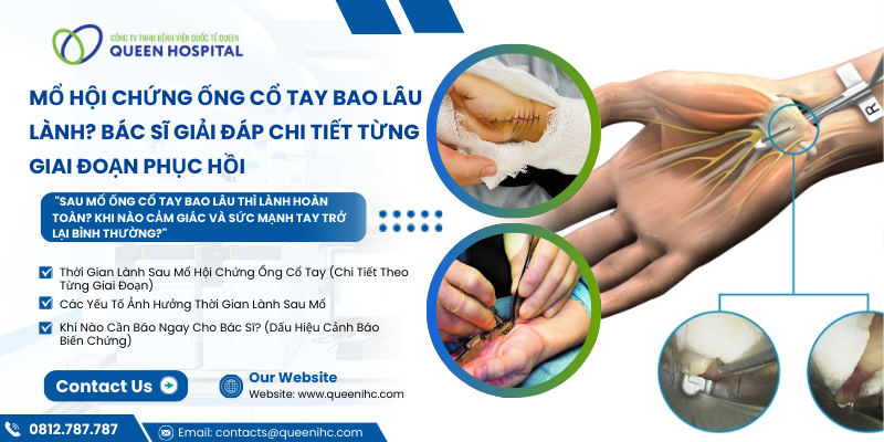 Mổ Hội Chứng Ống Cổ Tay Bao Lâu Lành