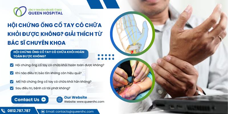 Hội Chứng Ống Cổ Tay Có Chữa Khỏi Được Không