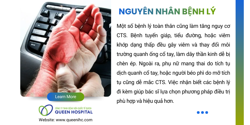 nguyên nhân hội chứng ống cổ tay