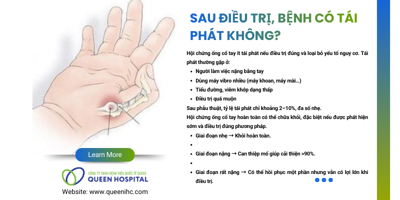 Hội Chứng Ống Cổ Tay Có Chữa Khỏi Được Không