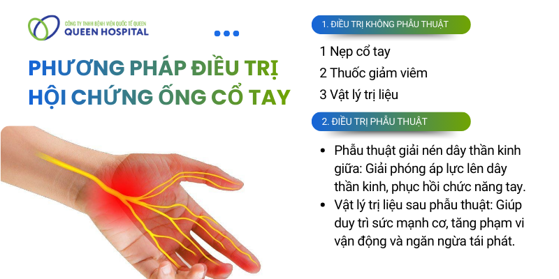 Điều Trị Hội Chứng Ống Cổ Tay
